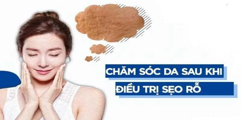 trị sẹo rỗ