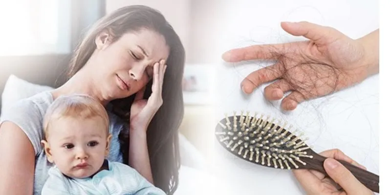 Nguyên Nhân Gây Rụng Tóc Sau Sinh